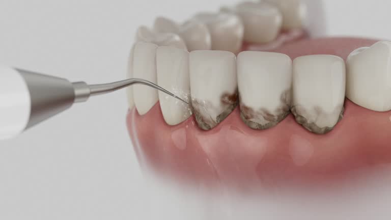 Reliable Dental Implants contractor in Dovesville, SC by Smile Center Dentistry